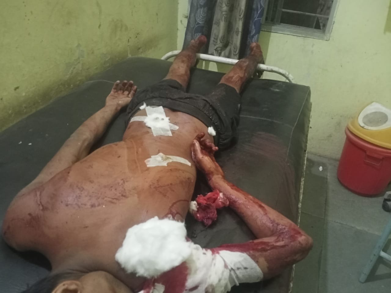 युवक कुश यादव पर पड़ोसी ने धारदार हथियार से किया प्राणघातक हमला, आरोपी की नहीं हो रही गिफ्तारी 1 IMG 20250328 WA0275 kshititech